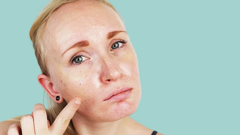 Combination Skin Products to Avoid