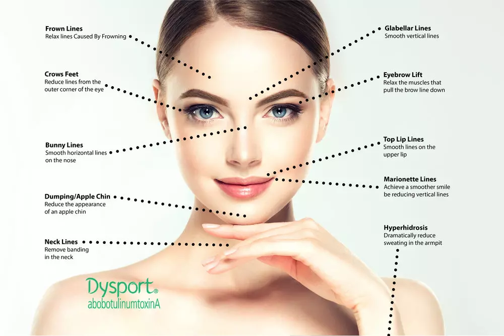 Dysport Treatment at Femme Aesthetics Miami