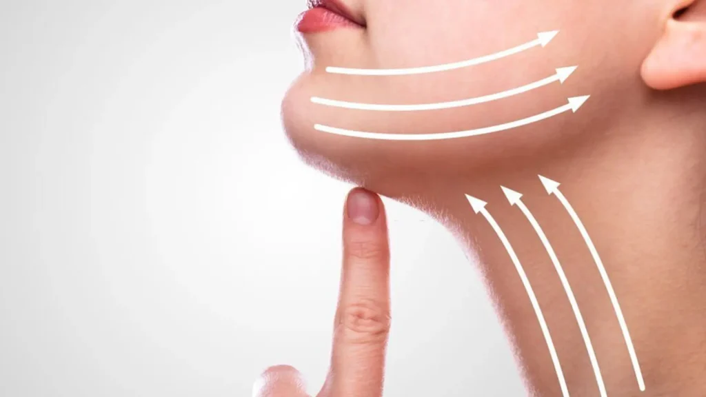 Ideal candidate for Nefertiti Neck Lift treatment