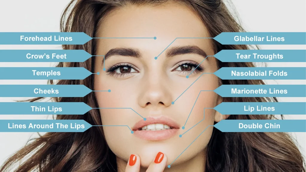 Lip Fillers Treatment Areas