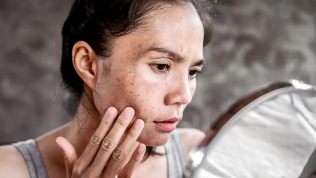 Protective Measures for Sun Damaged Skin