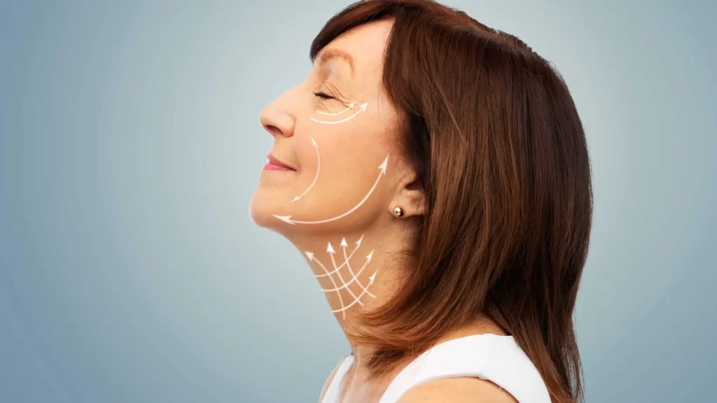 Lo básico de Sculptra vs Radiesse