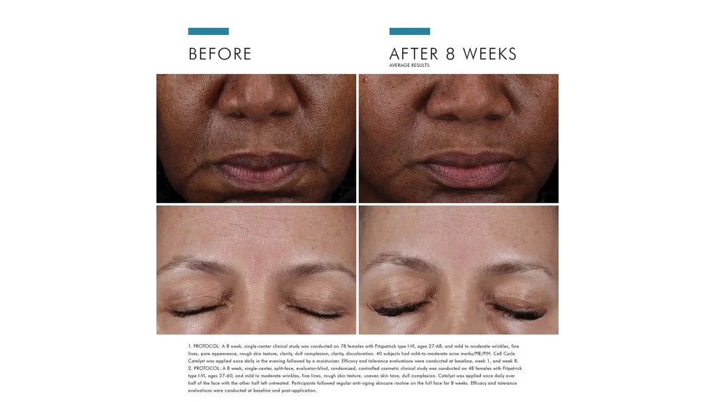 Skinceuticals Cell Cycle Catalyst Before and After Results