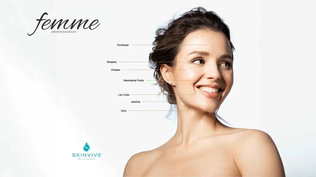 Skinvive by Juvéderm facial areas treatment at Femme Aesthetics