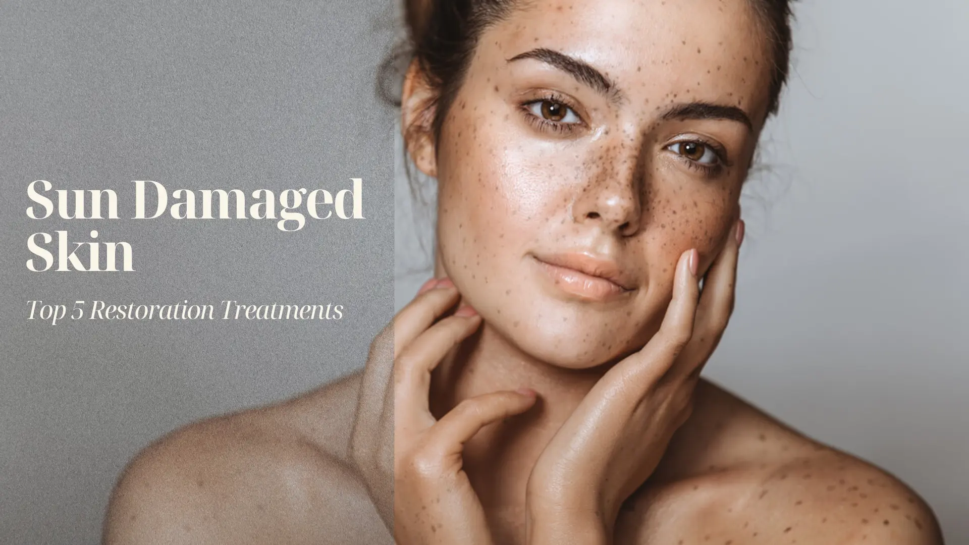 Treating Sun Damaged Skin