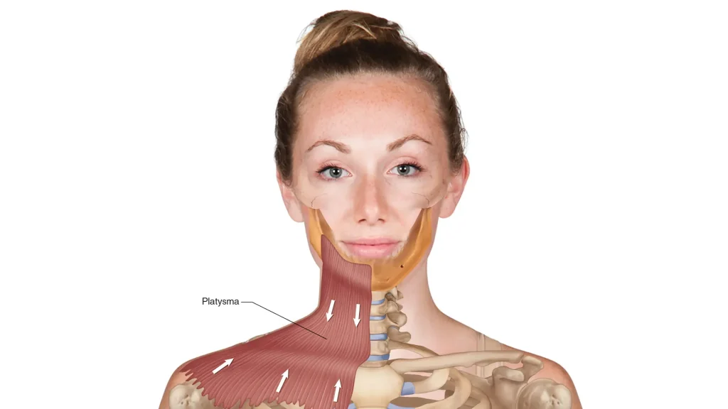 Understanding the neck muscles and aging effects on the platysma