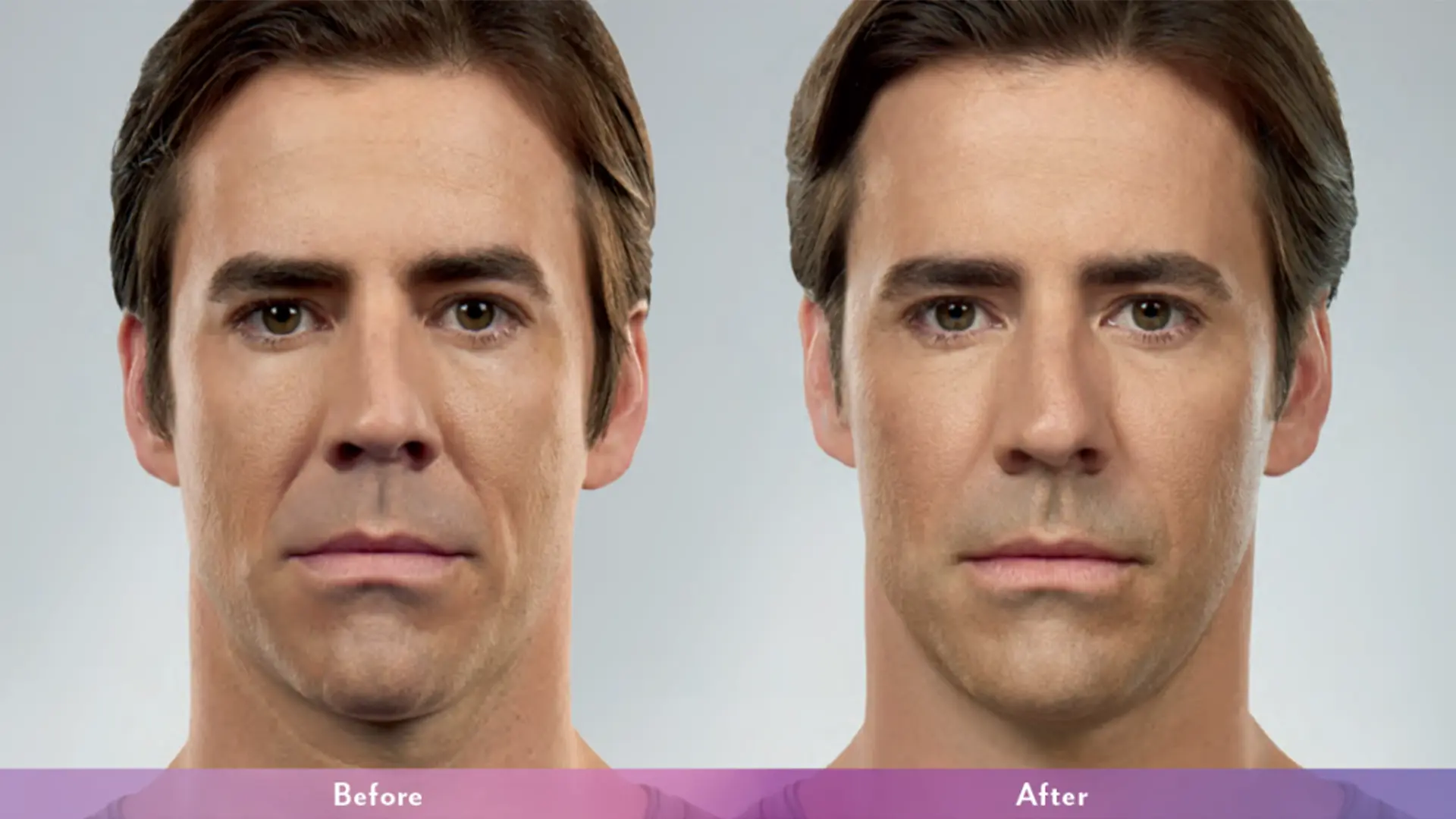 before and after 2