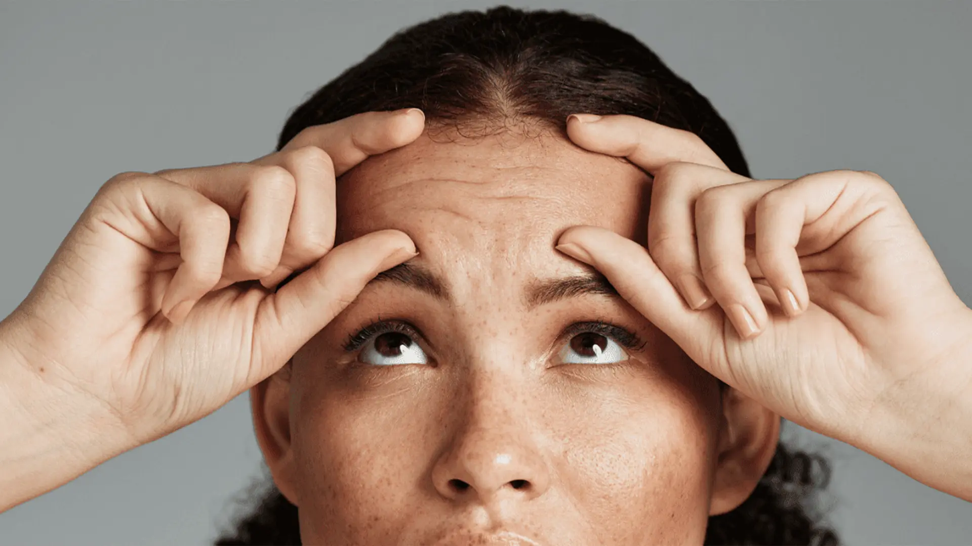 Beneficios del tratamiento de botox preventivo