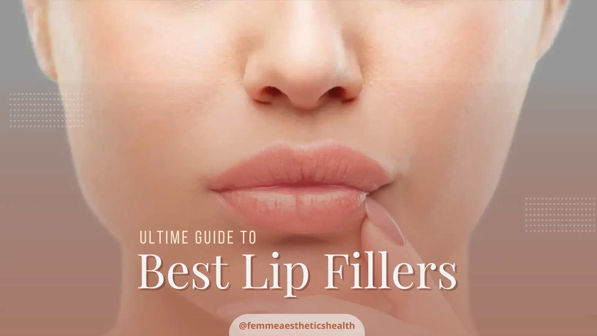 Best lip filler guide showing natural lip enhancement results