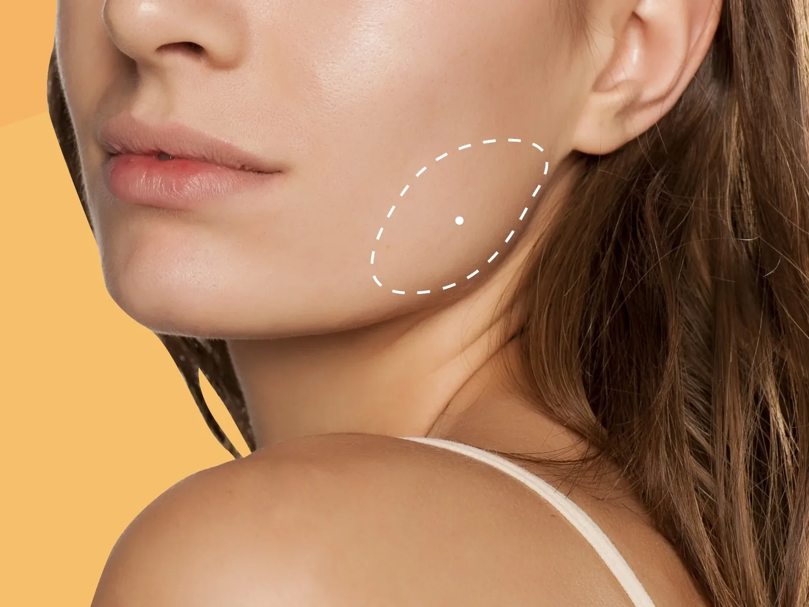 Botox for masseter muscle reduction