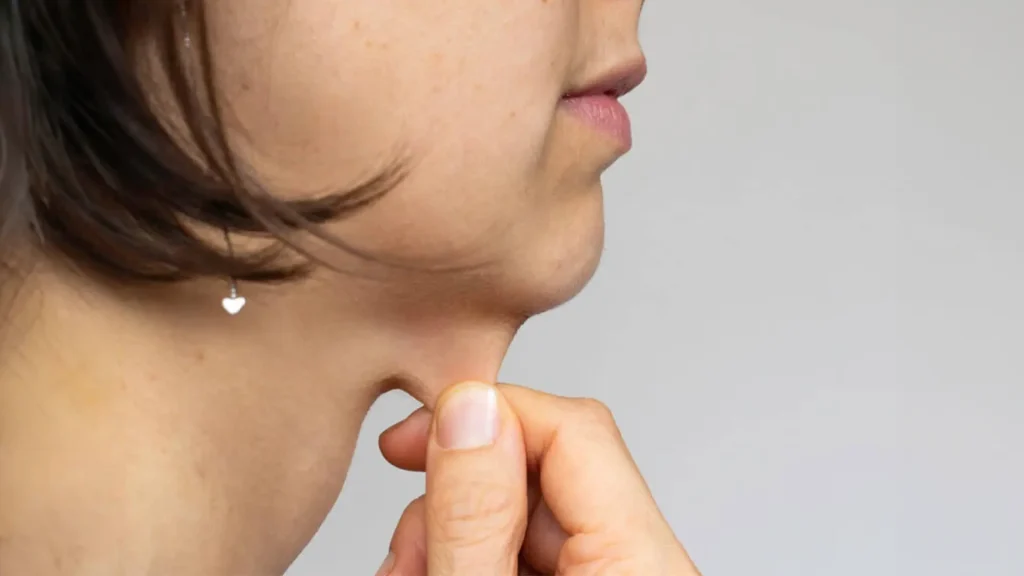Chin sagging skin