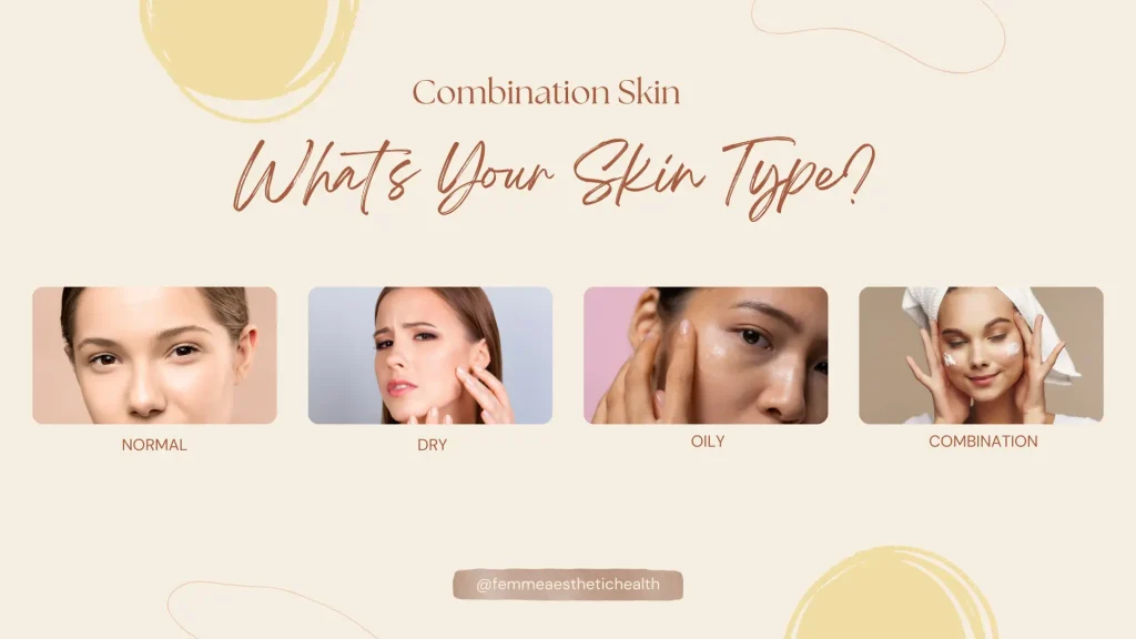 Combination Skin - What's Your Skin Type
