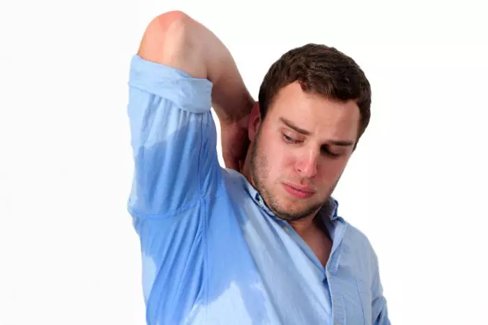 Botox treatment for excessive sweating and hyperhidrosis