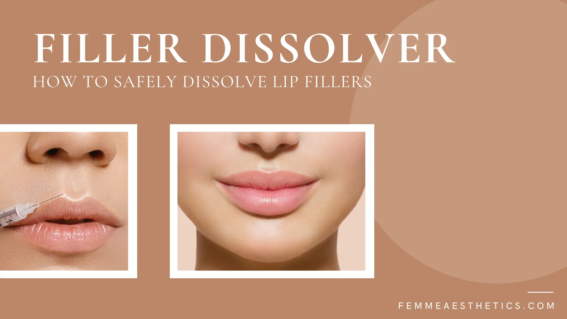filler dissolver femme aesthetics miami