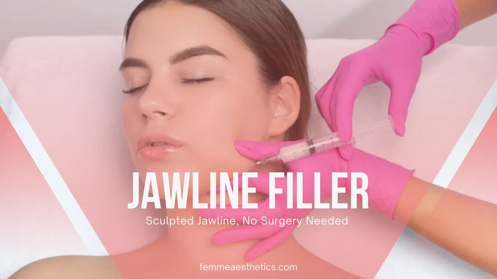 Jawline filler treatment in Miami