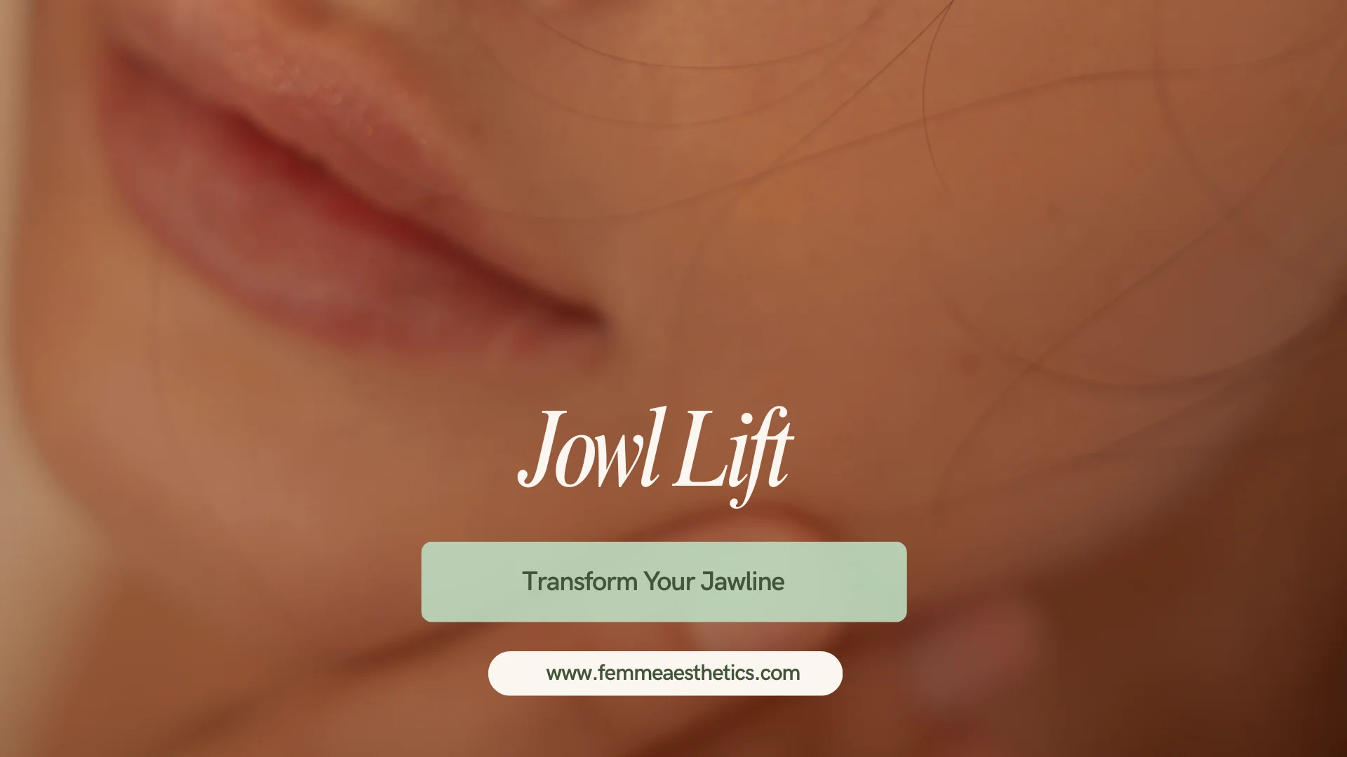 Jowl Lift - Transform Your Jawline at Femme Aesthetics Miami