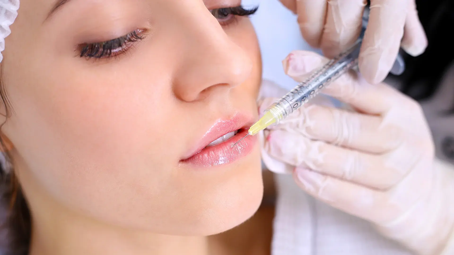 The lip filler procedure and injection techniques at Femme Aesthetics