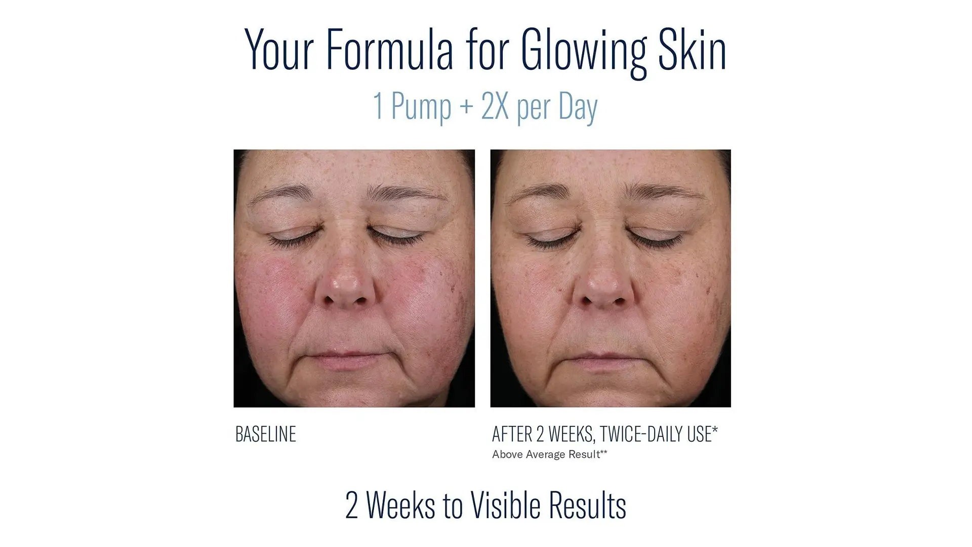 skinbetter before and after