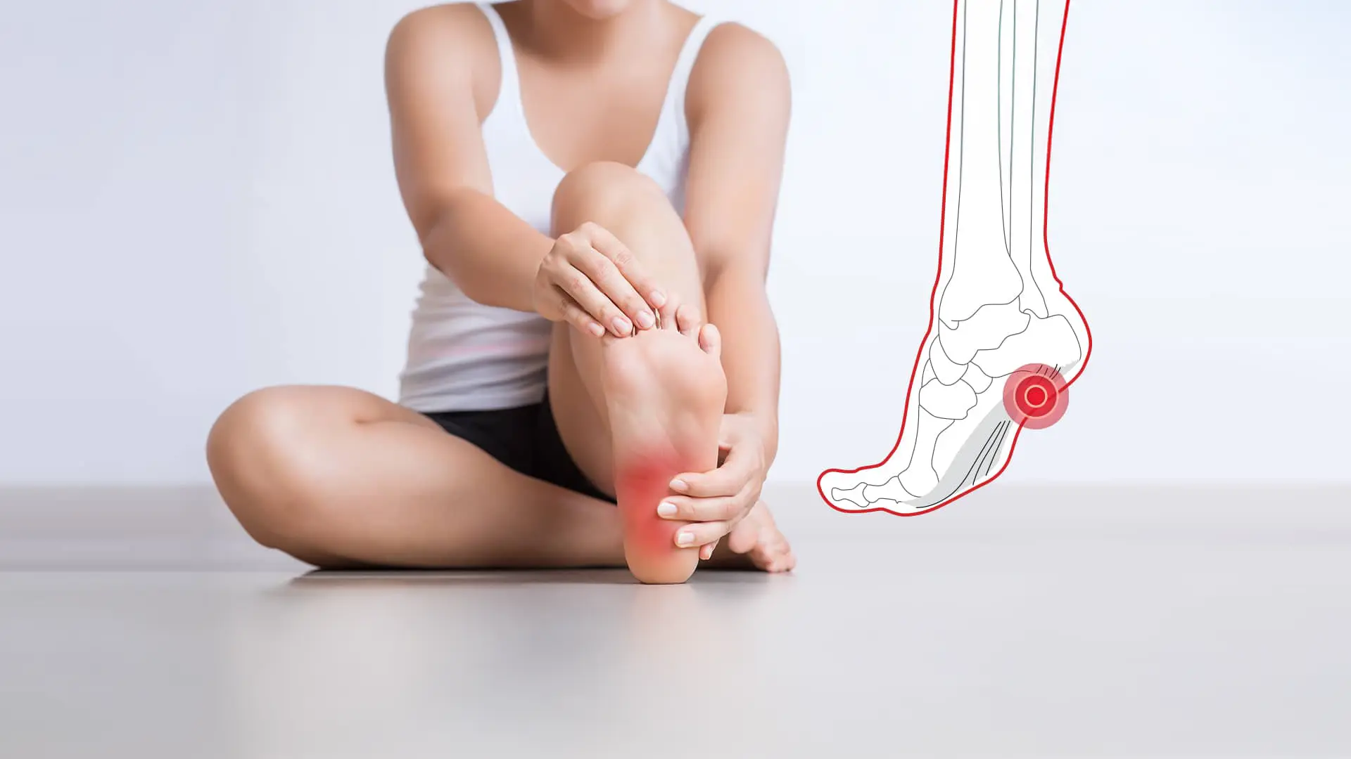 What causes plantar fasciitis &ndash; risk factors and contributing conditions