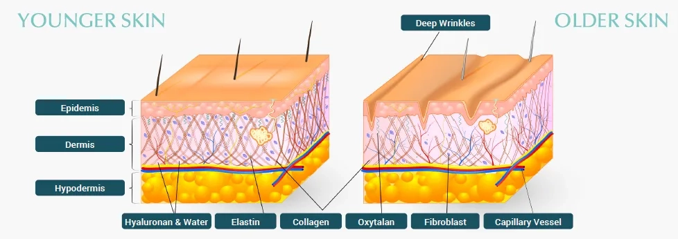 Comparison of younger skin versus older skin showing collagen differences