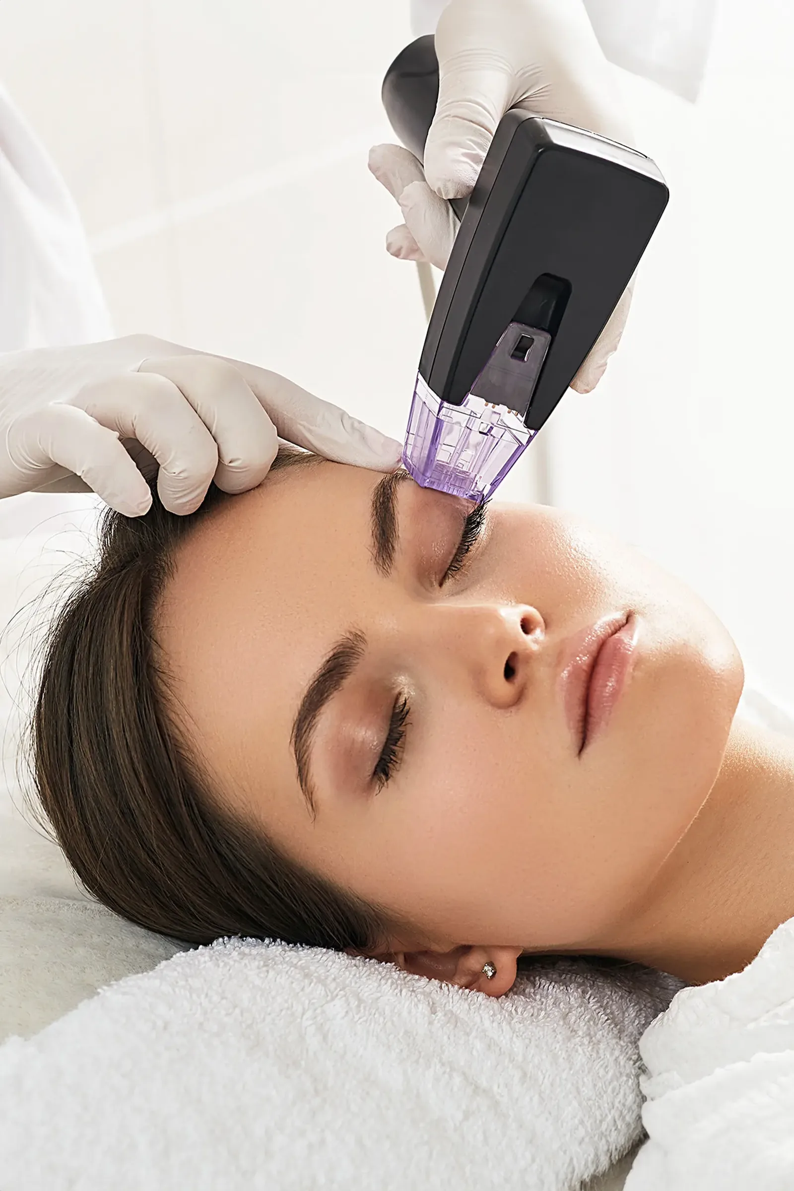 Intense Pulsed Light treatment